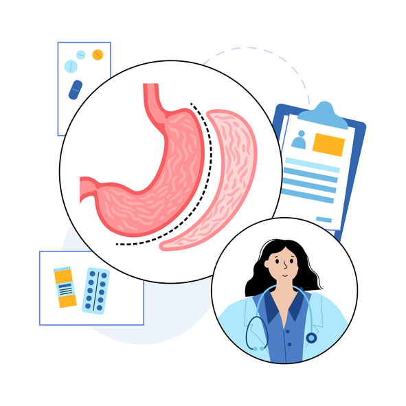 Les 10 questions les plus fréquemment posées sur la gastrectomie